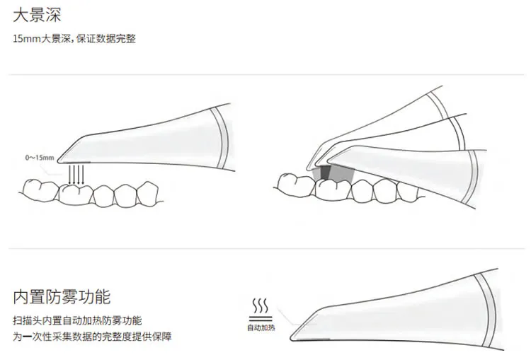 菲森口扫_r3_c1.webp