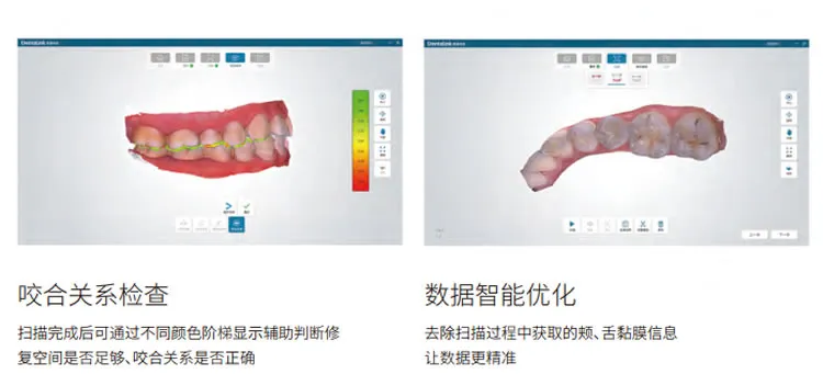 菲森口扫_r2_c1.webp