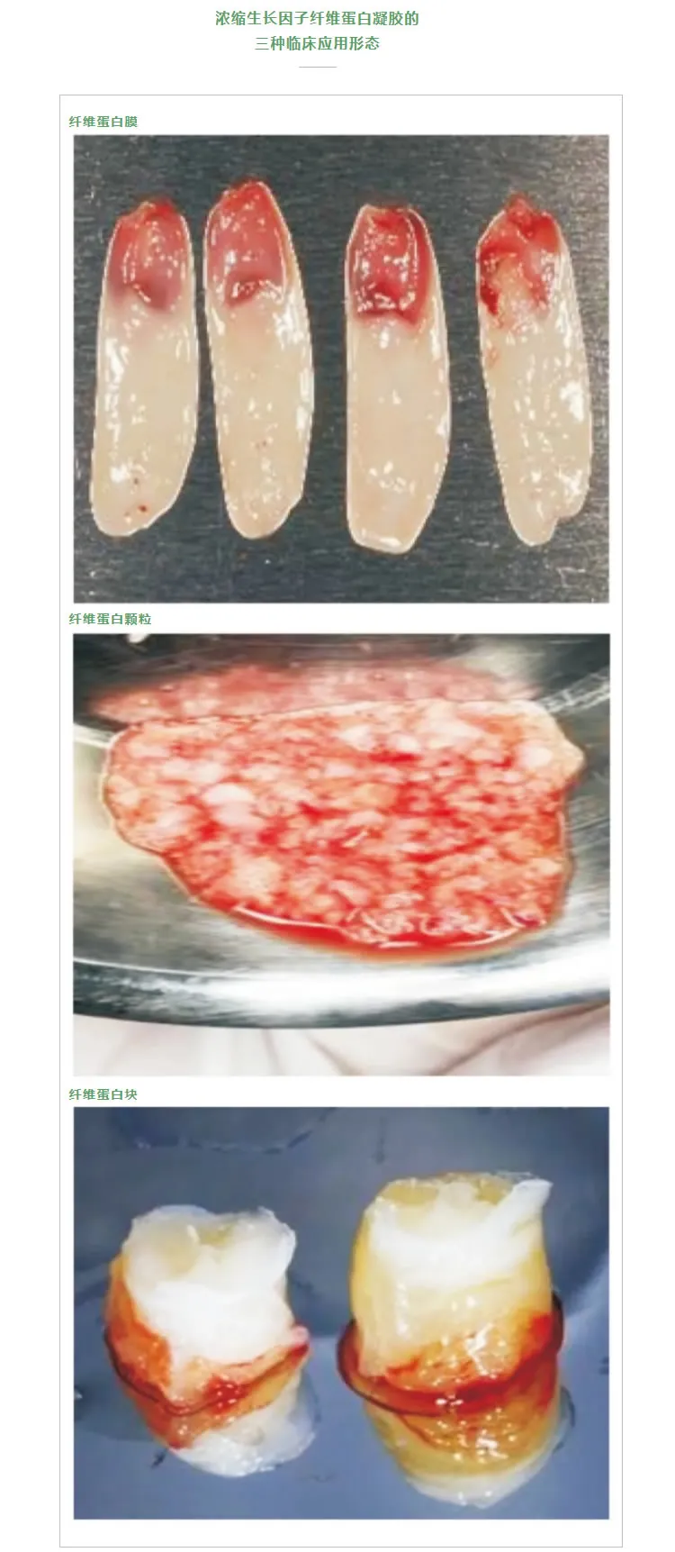 湘启 TD4E口腔专用离心机2_r2_c1.webp 湘启 TD4E口腔专用离心机2_r2_c1.webp