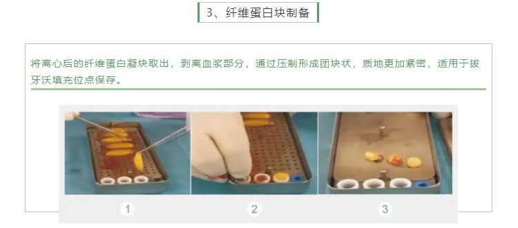 湘启 TD4E口腔专用离心机2_r5_c1.webp