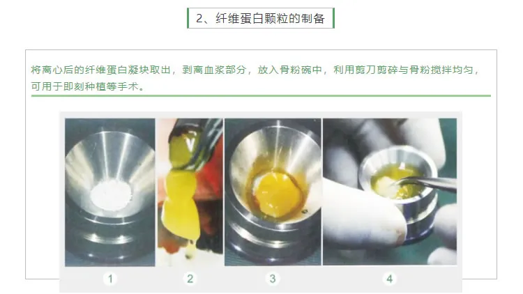 湘启 TD4E口腔专用离心机2_r4_c1.webp