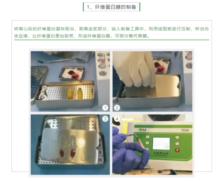 湘启 TD4E口腔专用离心机2_r3_c1.webp