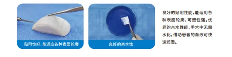 兰度 骨膜1_r7_c1.webp 兰度 骨膜1_r7_c1.webp