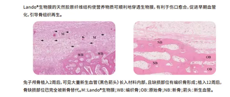 兰度 骨膜1_r5_c1.webp 兰度 骨膜1_r5_c1.webp