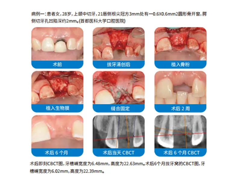 兰度 骨膜1_r10_c1.webp 兰度 骨膜1_r10_c1.webp