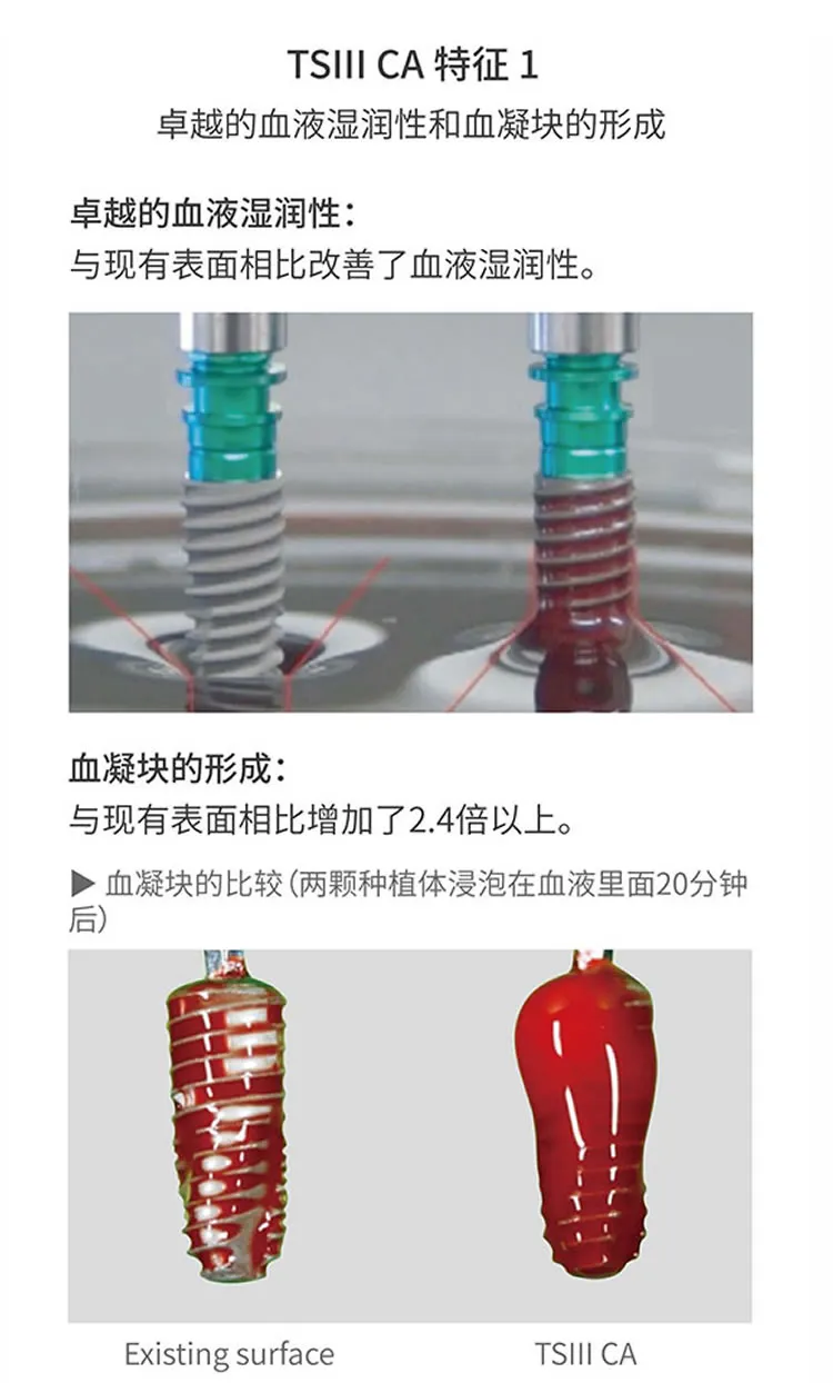 奥齿泰 TSIII CA 亲水种植体-_r1_c1.webp