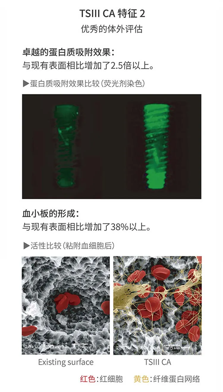 奥齿泰 TSIII CA 亲水种植体-_r2_c1.webp