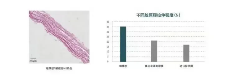 瑞拜欧 骨膜1_r5_c1.webp 瑞拜欧 骨膜1_r5_c1.webp