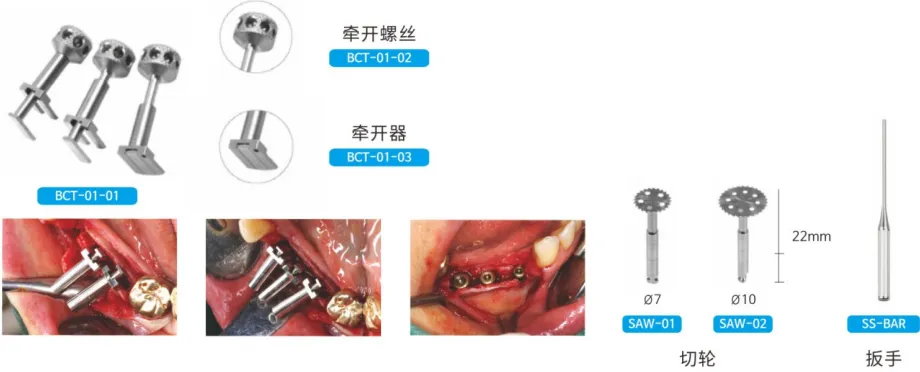 牵开螺丝1.webp