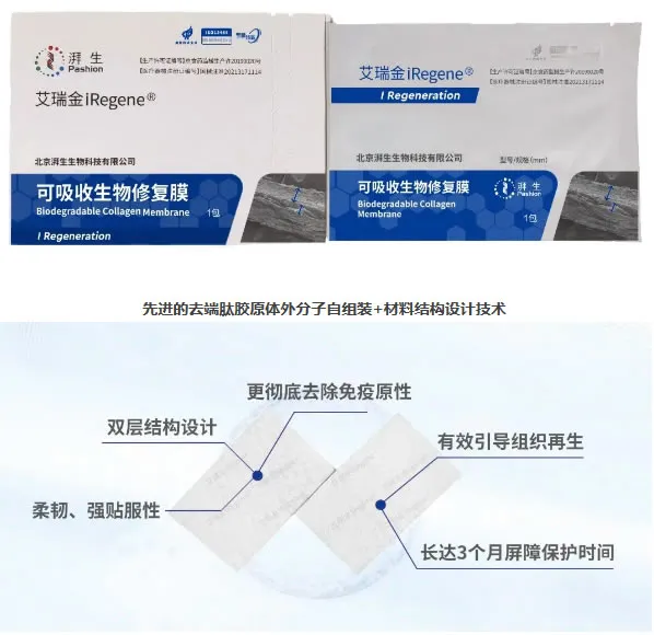 艾瑞金 生物膜.webp 艾瑞金 生物膜.webp