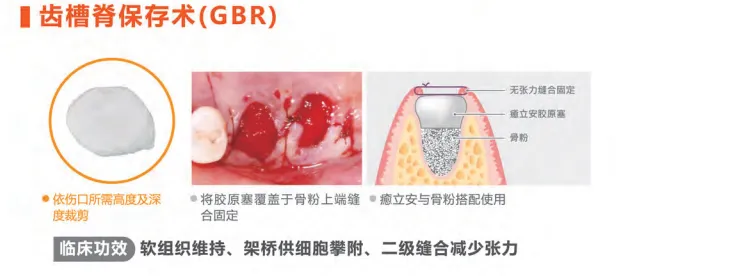 image.webp image.webp