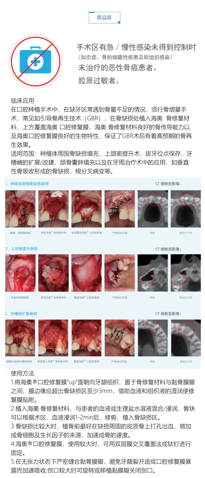 海澳骨粉2.webp 海澳骨粉2.webp