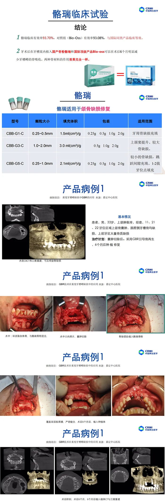 骼瑞 天然煅烧骨修复材料骨粉1.webp 骼瑞 天然煅烧骨修复材料骨粉1.webp