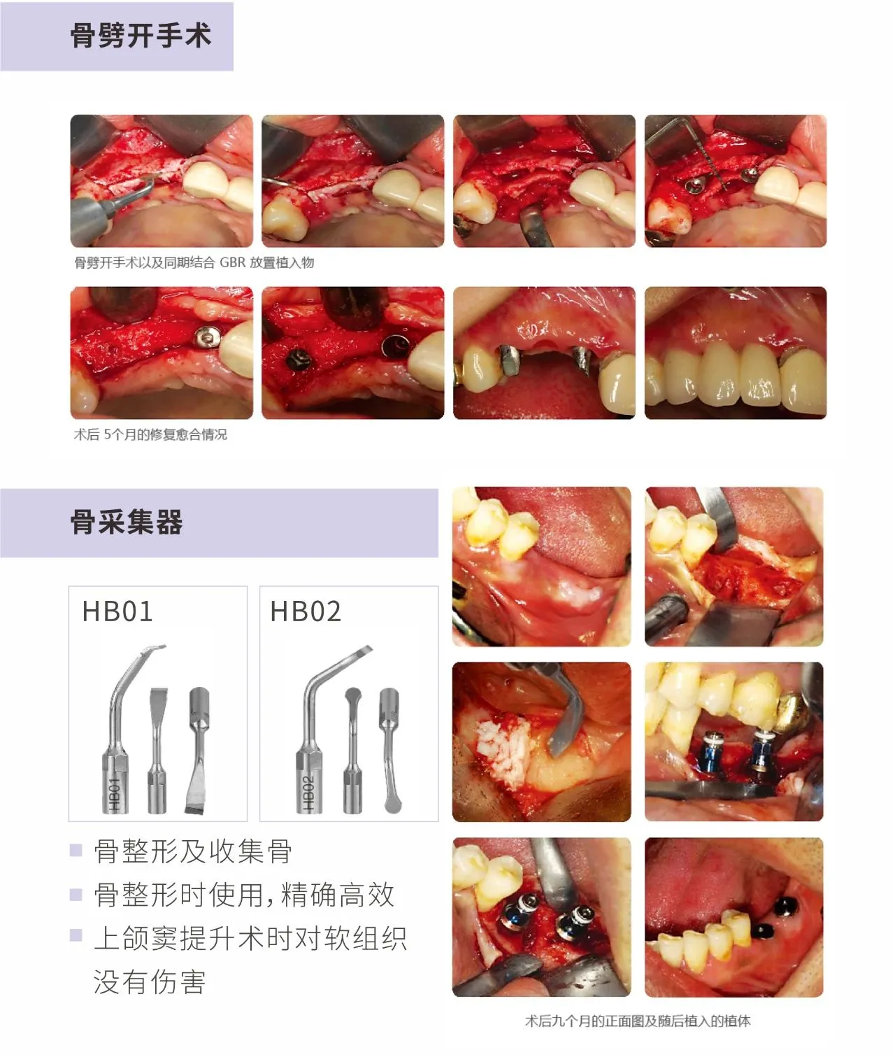 MINA 超声骨刀piezo master-17.webp