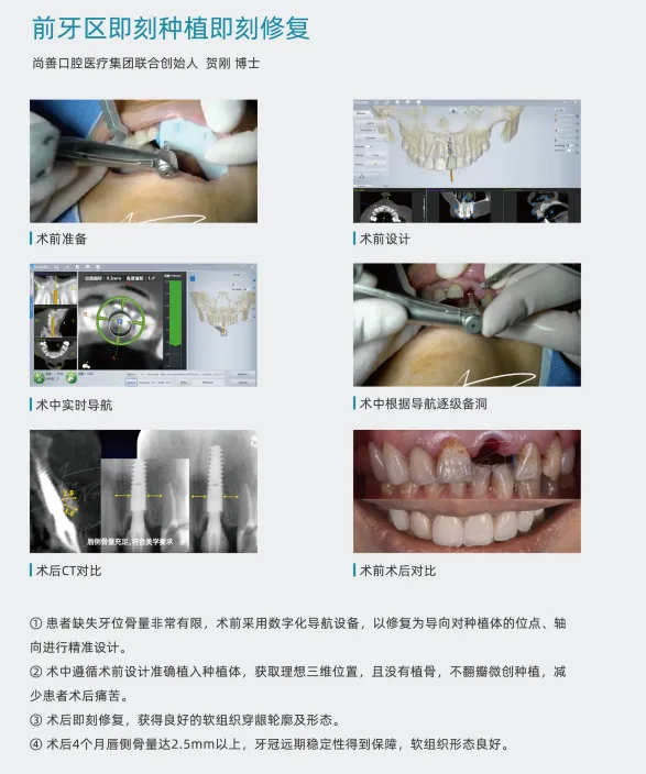 image.webp image.webp