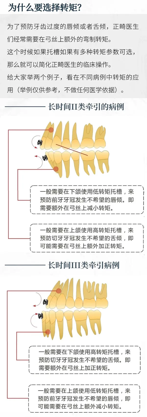 PT5 2.webp