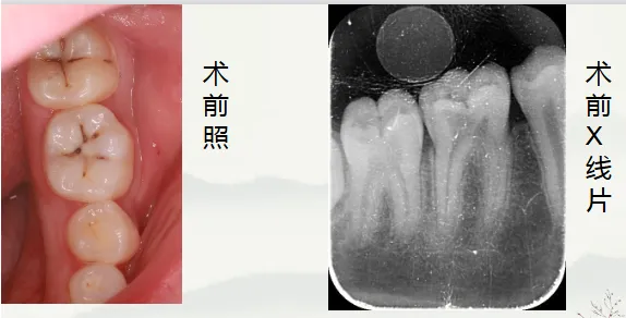 image.webp image.webp