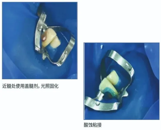 image.webp image.webp