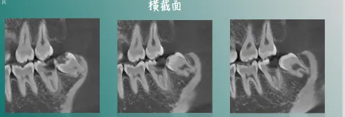 image.webp image.webp