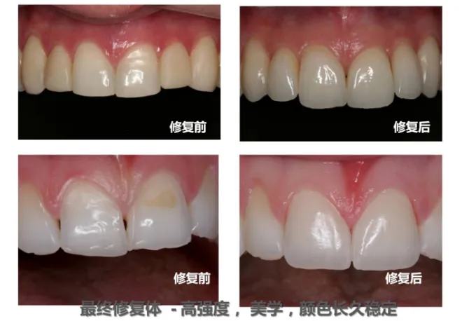 image.webp image.webp