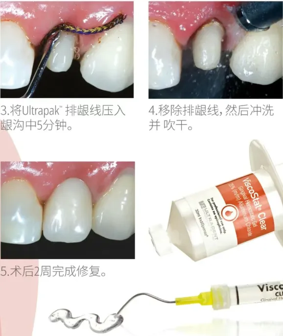 image.webp image.webp
