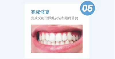 微信图片_2026-04-19_150135_387_r17_c1.webp