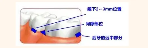 image.webp
