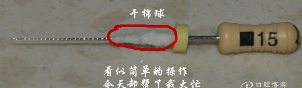 钢牙 烤瓷冠 不破冠确定工作长度(小方法）